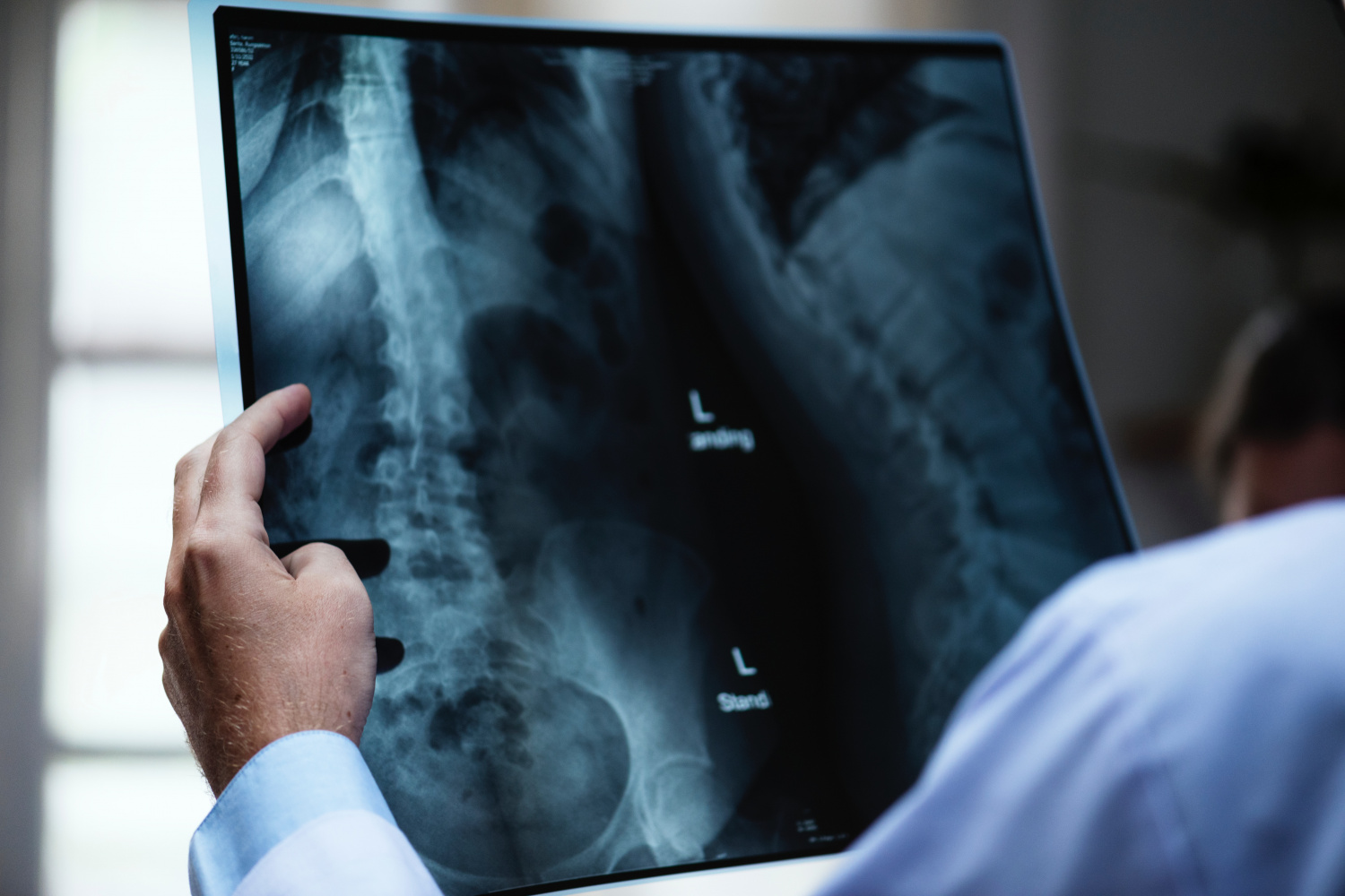 Производители рентгенов получили льготу по налогу на прибыль